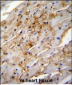 ALDH1L2 Antibody (C-term)